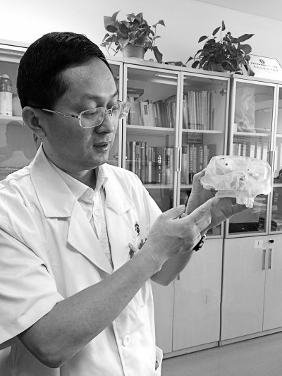 醫(yī)療3d打印應用實例 3D打印精準“再造”上頜骨
