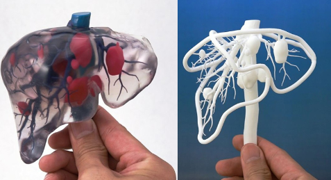 簡述現(xiàn)階段醫(yī)用3D打印設(shè)備和打印材料的相關(guān)進展_e鍵3D打印服務(wù) 簡述現(xiàn)階段醫(yī)用3D打印設(shè)備和打印材料的相關(guān)進展_e鍵3D打印服務(wù)