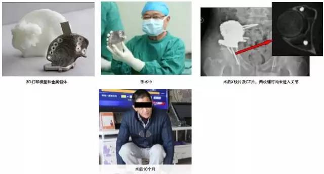 3d打印在醫療領域的應用 3D打印與醫療行業白皮書 3d打印在醫療領域的應用 3D打印與醫療行業白皮書