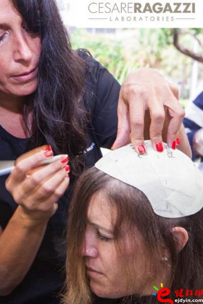 另類治療脫發(fā)的最好方法 用3D打印超逼真假發(fā)解決困擾 治療脫發(fā)不再煩,3d打印頭發(fā),假發(fā)3d模型,3d打印材料,3d打印服務,3d打印廠家 另類治療脫發(fā)的最好方法 用3D打印超逼真假發(fā)解決困擾 治療脫發(fā)不再煩,3d打印頭發(fā),假發(fā)3d模型,3d打印材料,3d打印服務,3d打印廠家