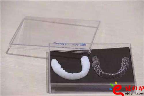 3D打印牙嵌體和牙套哪種更好？3D打印牙齒/隱形牙套/牙冠/模型/成品價格表